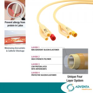 Connecx - 3 Way Latex Foley Catheter, Siliconised 30ml (10pcs/box) Connecx - 3 Way Latex Foley Catheter, Siliconised 30ml (10pcs/box)