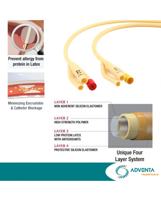 Connecx - 3 Way Latex Foley Catheter, Siliconised 30ml (10pcs/box) - Connecx